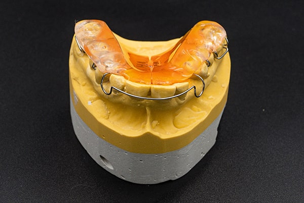 A removable orthodontic appliance on its working model.