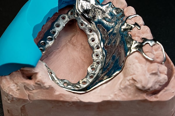 A cast implant-retained metal framework seated on its master model at Inline Dental.